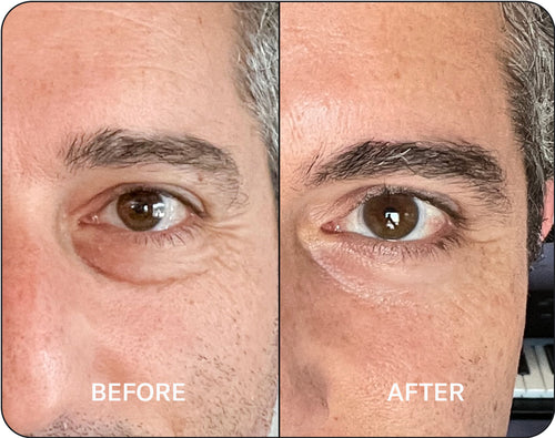 Before and After