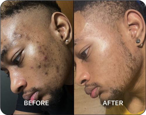 Before and After