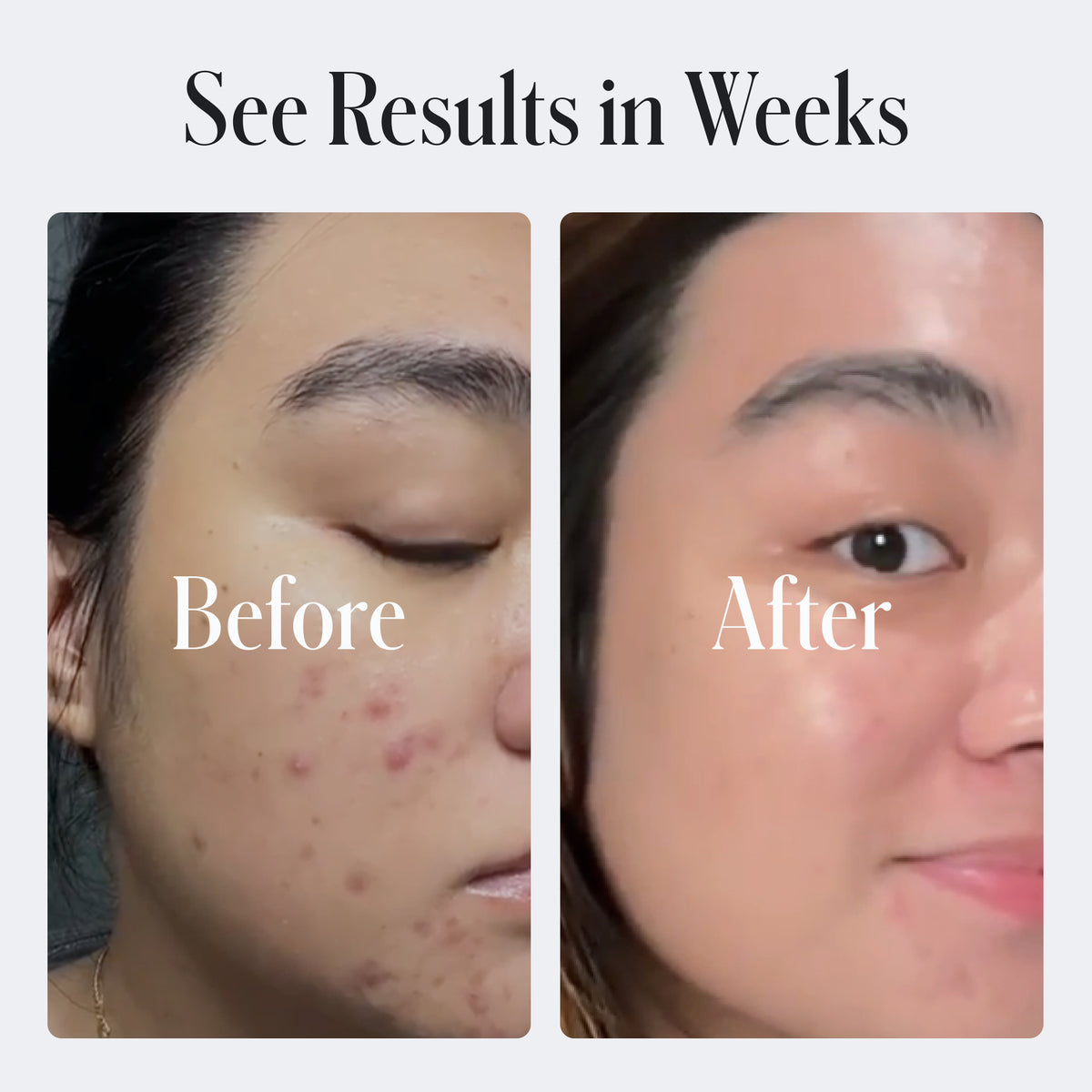 Clear System Starter Routine