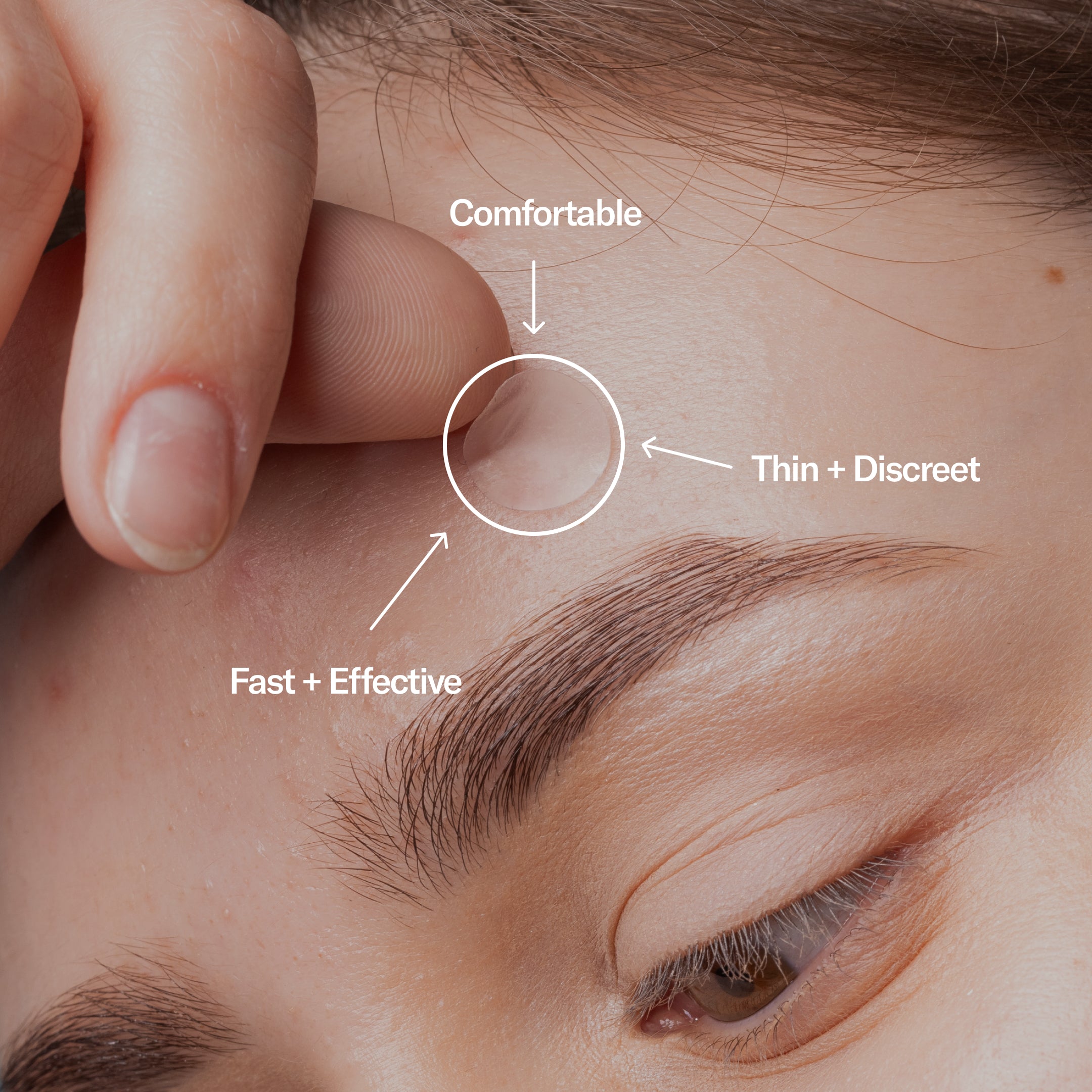 Close-up of a person's eye with annotations pointing to a small circular Zit Zapper Pimple Patch by Geologie on the skin, highlighting features like 