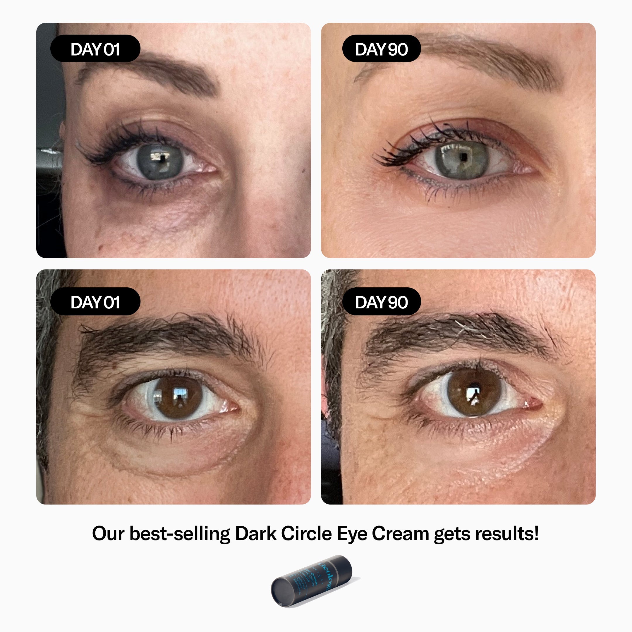 Geologie Complete Skincare Sample Set - Dark Circle Eye Cream Results - Female and Male Under Eye Dark Circles Before + After