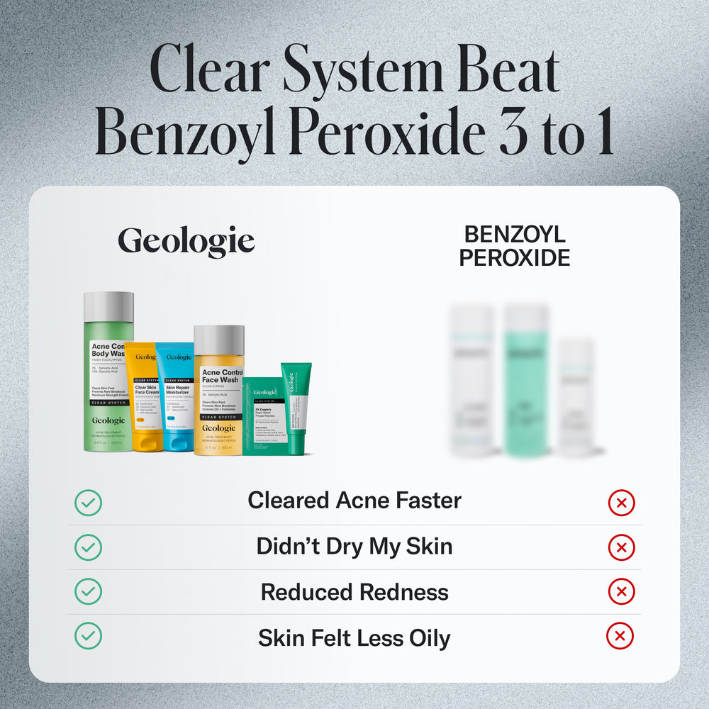 Comparison chart showing Geologie’s Clear Skin Face Cream vs. Benzoyl Peroxide, highlighting faster acne clearing, less dryness, reduced redness, and less oily skin due to ingredients like azelaic acid.
