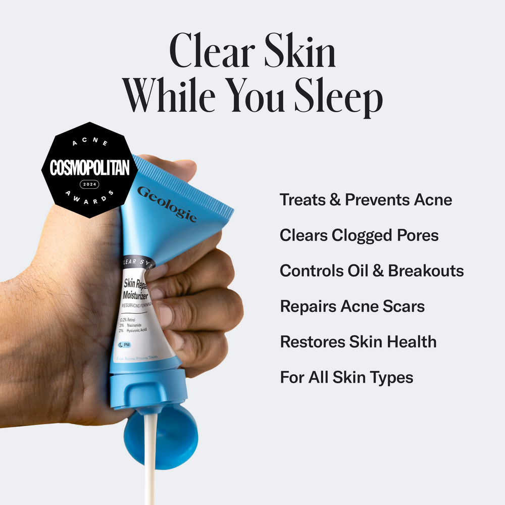 Hand holding a tube of Geologie's Skin Repair Moisturizer, highlighting its benefits for acne treatment, clear pores, and skin health. Cosmopolitan award mentioned on the label.