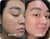 Before and After
