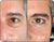 Before and After
