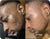 Before and After